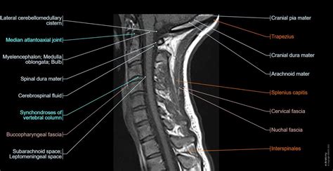 Cervical Spine Mri Normal Anatomy E Anatomy Cervical Spine Mri Normal Anatomy E Anatomy