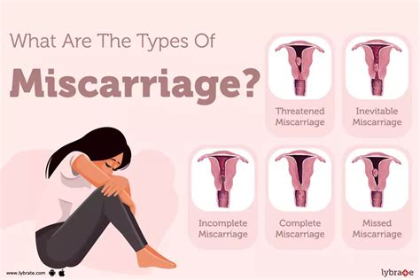Miscrage