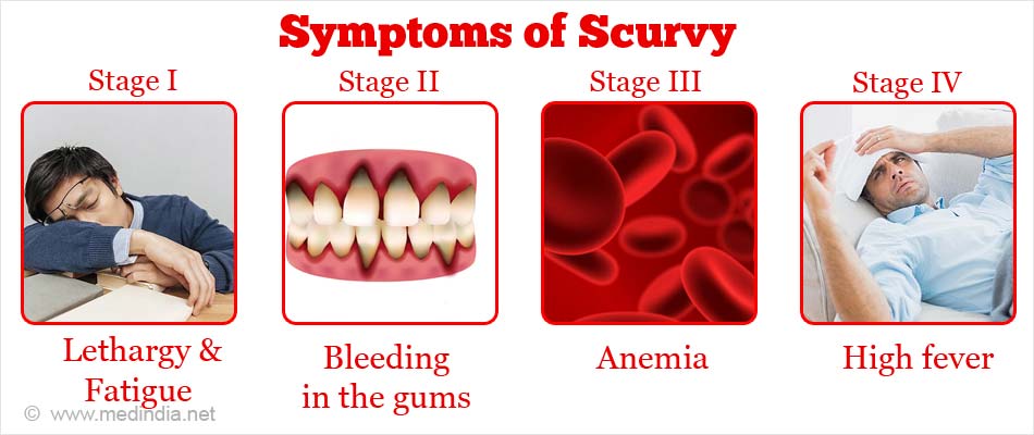 Scurvy Causes Signs Symptoms Treatment Home Remedies Prevention Scurvy Causes Signs Symptoms Treatment Home Remedies Prevention