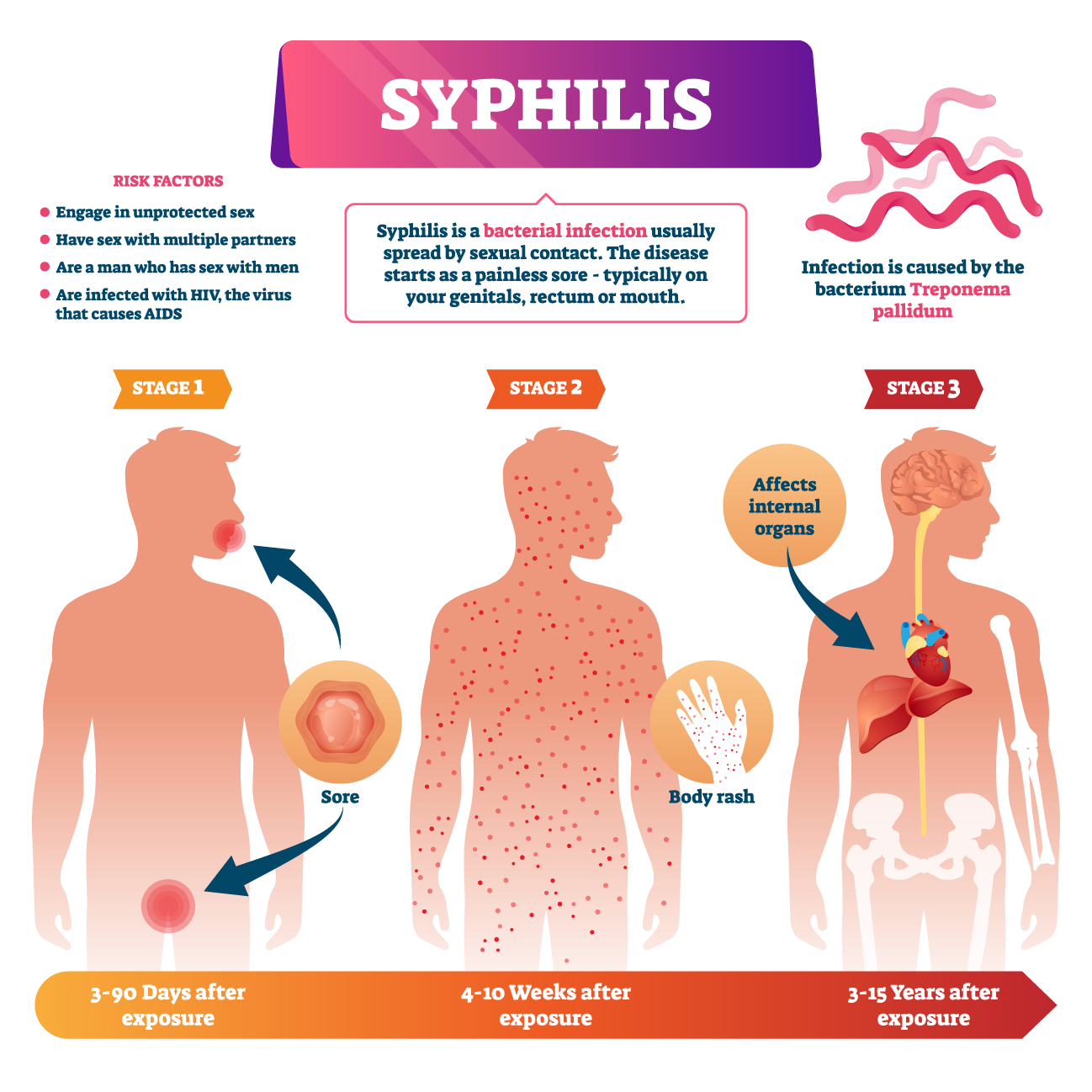 Syphilis Symptoms Treatment And Prevention Syphilis Symptoms Treatment And Prevention