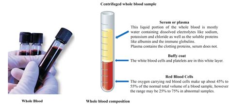 What Is A Centrifuged Blood Sample At Will Barkman Blog What Is A Centrifuged Blood Sample At Will Barkman Blog