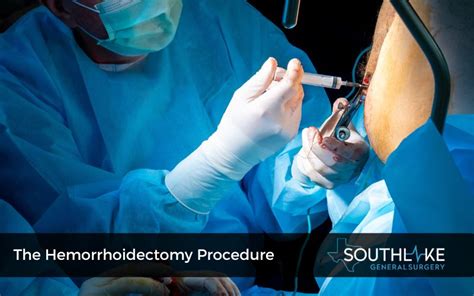 When You Need Surgery For Hemorrhoids How Do They Remove A Hemorrhoid When You Need Surgery For Hemorrhoids How Do They Remove A Hemorrhoid
