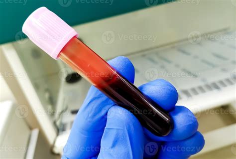 Whole Blood Test